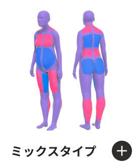 ミックスタイプ